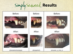 Simply Seaweed ~ Dental Health Supplement